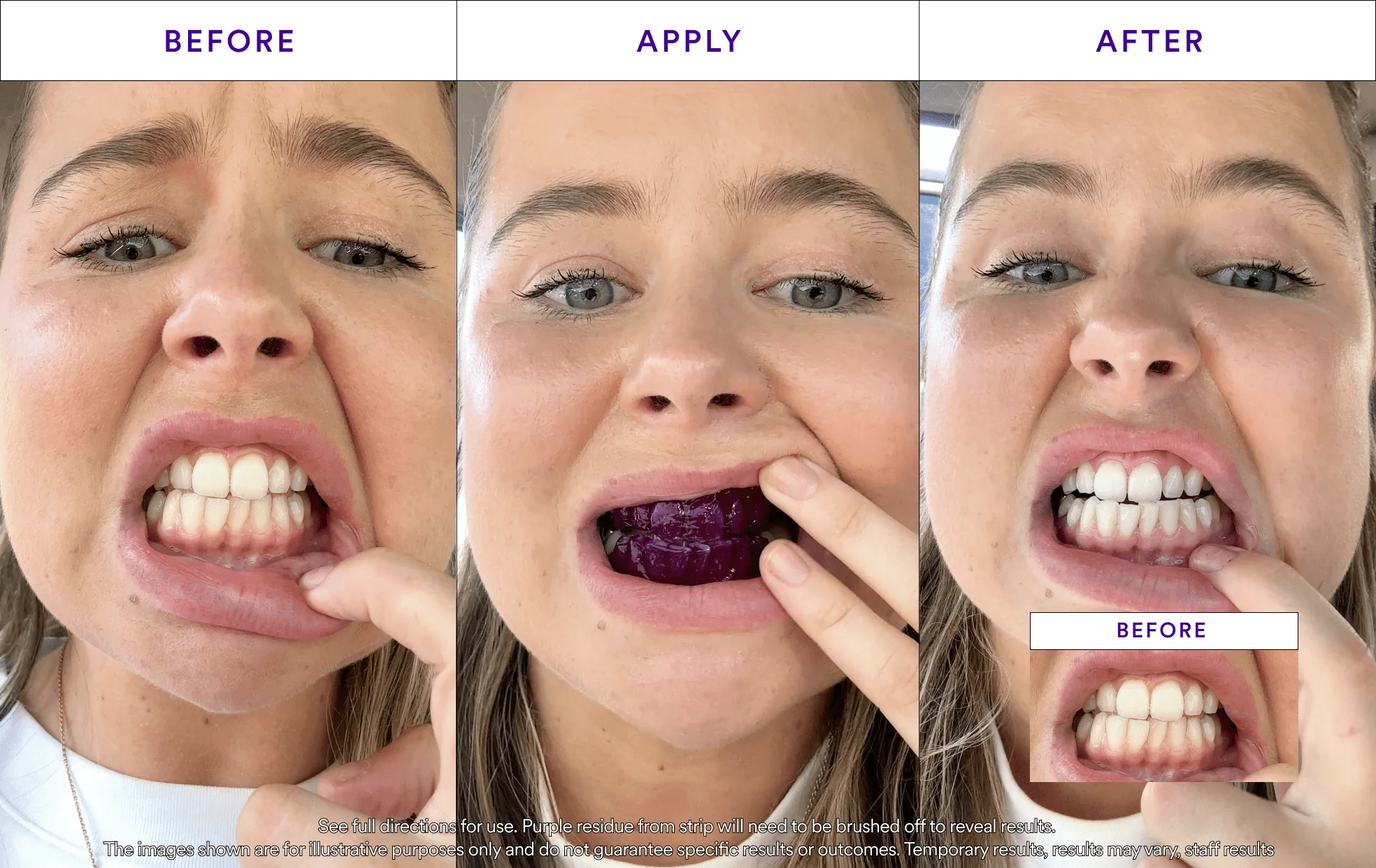 V34 Whitening Strips - Value 2 Pack - Image 6